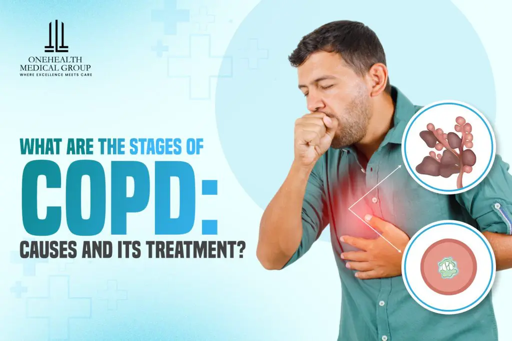 stages of copd